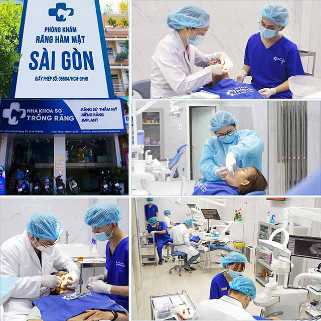 Phòng khám cấy ghép răng implant nổi tiếng ở Sài Gòn